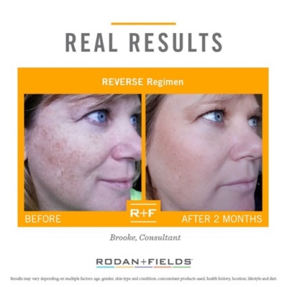 36 Single-Use Rodan+Fields “Reverse” Regimen Samples. For Discoloration. - Picture 4 of 5